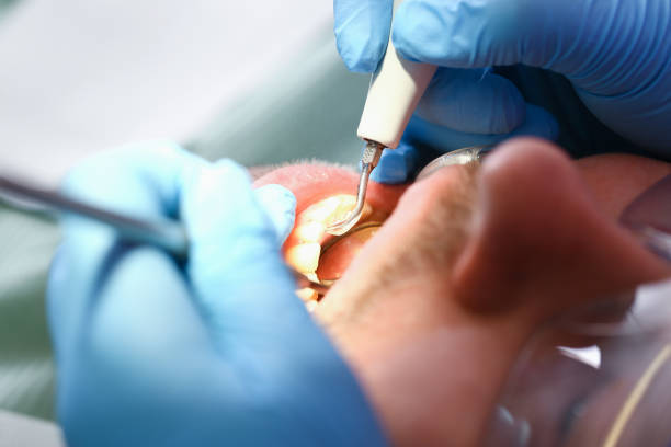 Best Weekend Emergency Dentist in Salineville, OH